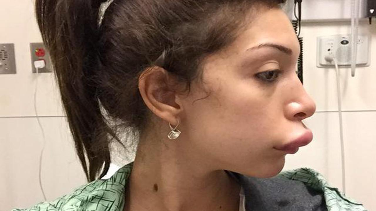 Farrah Abraham S Lip Injections Land Her In The Er