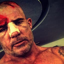 Dominic Purcell Breaks His Nose on 'Prison Break' Set After Bar Falls on His Head -- See the Gruesome Pics