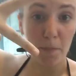 Lena Dunham Shares Her Endometriosis Scars in Bikini Selfie
