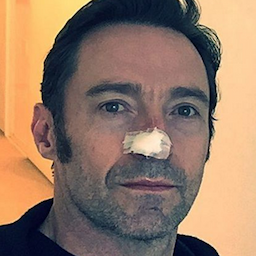 MORE: Hugh Jackman Has Another Skin Cancer Removed From His Nose, Assures Fans 'All's Well'