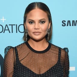 Chrissy Teigen Falls Down the Stairs and Bruises Herself the Day Before the Emmys