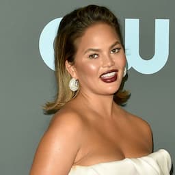 Chrissy Teigen Says She Chipped Her Tooth During 'Family Feud' Taping