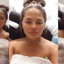 Chrissy Teigen Shares ‘Really Scary’ Updates Amid Pregnancy Complications