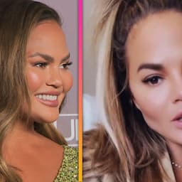Chrissy Teigen Shows Off Facial Cosmetic Surgery Results