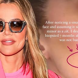 Khloe Kardashian’s Surgeon Speaks Out After Removing Tumor on Her Face