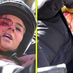 'Married at First Sight': See Emily's Quad Bike Crash & Bloody Injury