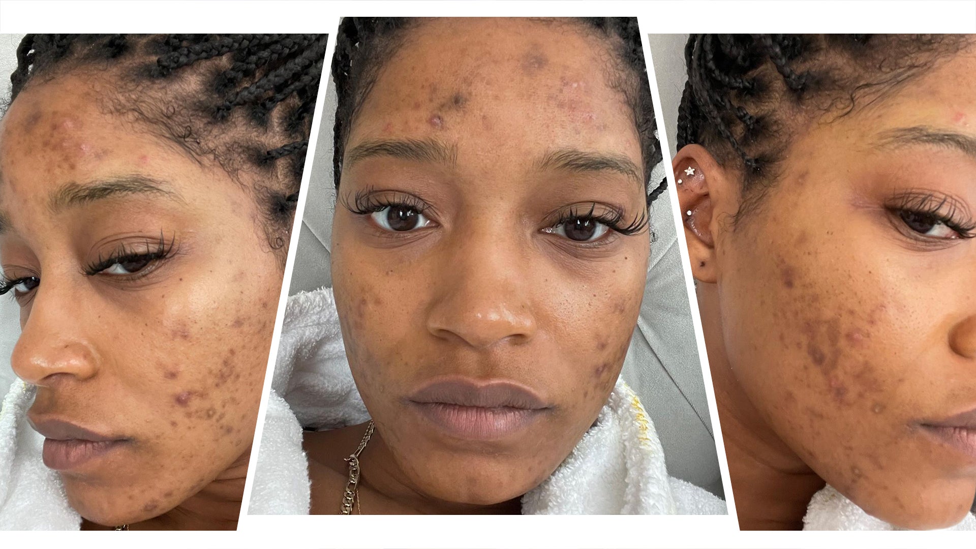 Keke Palmer Without Makeup | Makeupview.co