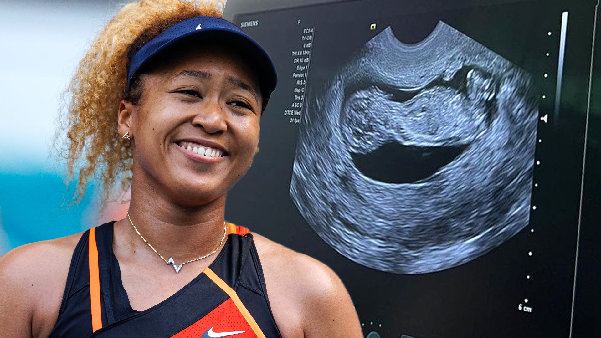 Naomi Osaka Reveals Sex of First Baby With Cordae Entertainment Tonight photo
