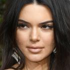 Kendall Jenner talks acne