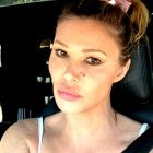 Brandi Glanville Fires Back at Comments on Her Looks, Talks Battle With Psoriasis (Exclusive)