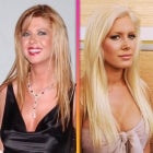 Celebrities Who Regret Their Cosmetic Procedures