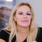 rhoslc star heather gay black eye