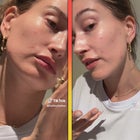 Hailey Bieber Goes Filter-Free and Shares Skincare Struggles