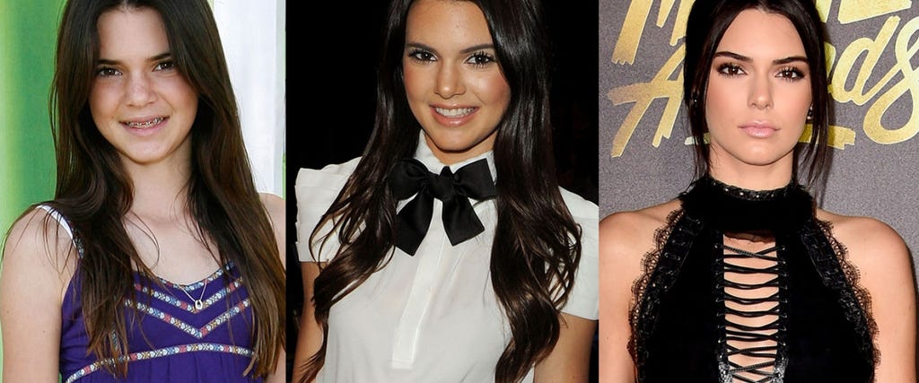 Kendall Jenner Through the Years