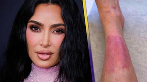 Kim Kardashian Gets Real About Psoriasis Struggle