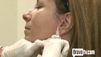 WATCH: 'Real Housewife' Jill Zarin Gets Liquid Facelift