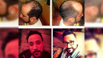 BSB A.J. McLean Reveals Hair Transplant