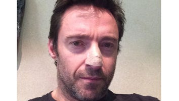 Jackman Credits Wife for Spotting Cancer Scare