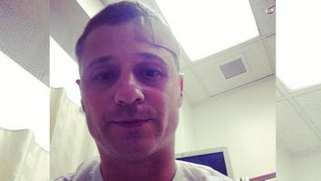 Ben McKenzie Rams Head Into Concrete While Filming 'Gotham'