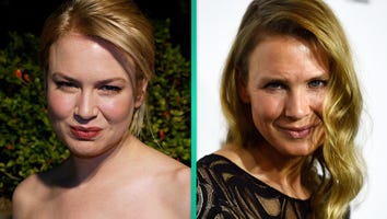 What Did Renee Zellweger Do to Her Face? Plastic Surgeon Weighs In