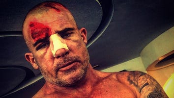 Dominic Purcell Breaks His Nose on 'Prison Break' Set After Bar Falls on His Head -- See the Gruesome Pics