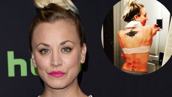 Kaley Cuoco Has 'Jumped on the Cupping Bandwagon' -- See the Pic!
