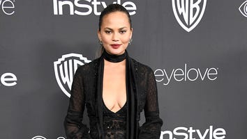 Chrissy Teigen Snapchats Pics of Her Painfully Bruised Legs After Day at Work