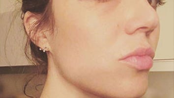 Mandy Moore Gets a Black Eye After Running Into Shower Door -- See the 'This Is Us' Cast React!