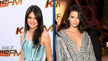 Kendall Jenner Opens Up About Her 'Ugly' Years and the Stress of Modeling