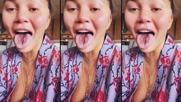 Why Chrissy Teigen Says Her Tongue is ‘Literally Falling Off’