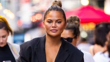 Chrissy Teigen Responds to Backlash Over Eyebrow Transplant