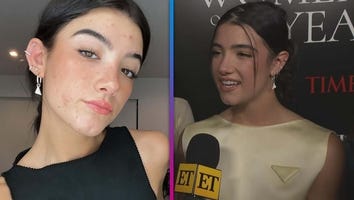 Charli D'Amelio on Her Acne Struggle and Choice to Share It With Her Fans (Exclusive)