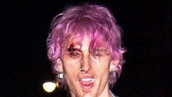 Machine Gun Kelly Has Blood Dripping Down His Face After Smashing a Champagne Flute on His Head