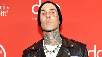 Travis Barker Shares Graphic Photos of His Injured Finger, Says He Wouldn't Play Drums Again Without Surgery