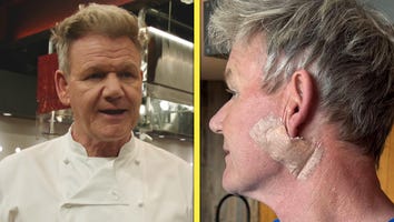 Gordon Ramsay Reveals Skin Cancer Surgery
