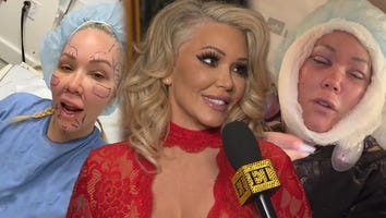 Bunnie XO Shares Unfiltered Plastic Surgery Results