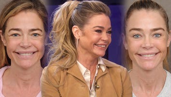 Denise Richards Shares Shocking Before and After Facelift Transformation