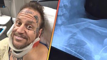 Jelly Roll Rushed to Hospital After Flipping ATV in Terrifying Crash