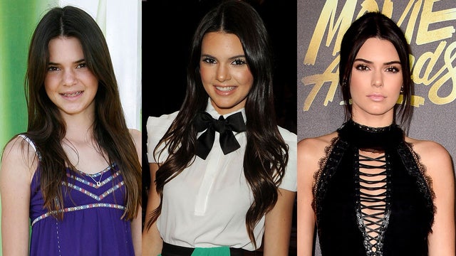 Kendall Jenner Through the Years
