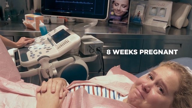 'Expecting Amy' Sneak Peek Reveals an Emotional Pregnancy Moment (Exclusive)