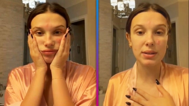 Millie Bobby Brown Opens Up About Her Acne in New Makeup-Free Video