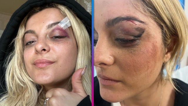Bebe Rexha Struck in Face With Cellphone During NYC Show