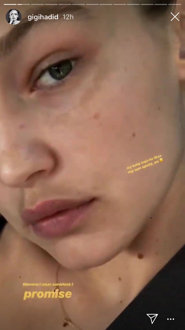 Gigi Hadid Says Baby Zayn Malik Likes My Sun Spots In