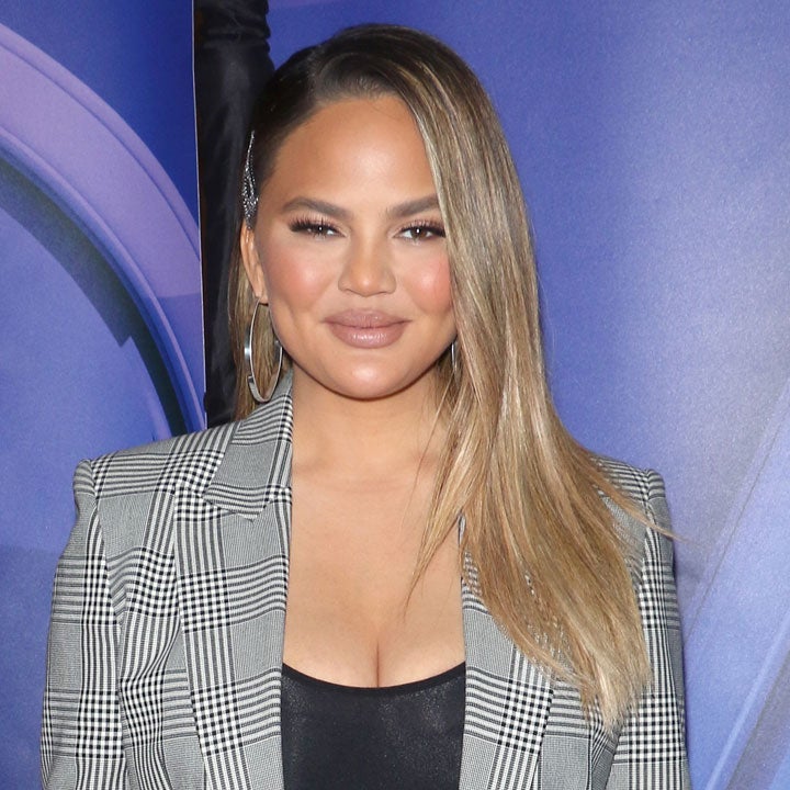 Chrissy Teigen Shows Off Scars After Getting Breast Implants Removed