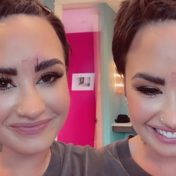 Demi Lovato Reveals Gnarly Face Injury That Requires Stitches