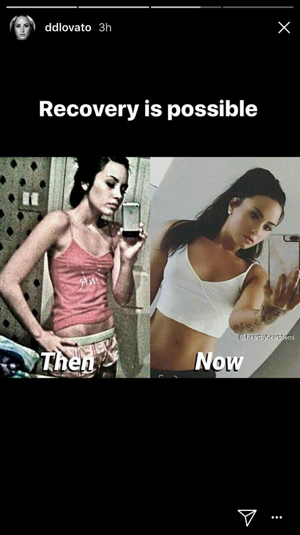 Demi Lovato shares before and after photos