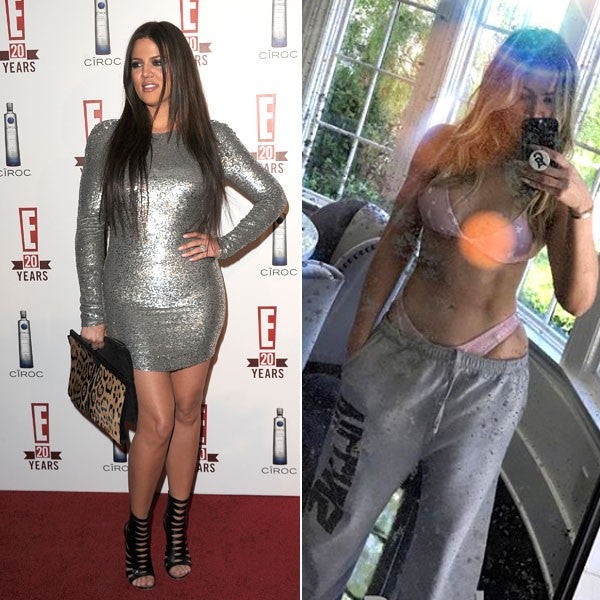 Khloe Kardashian before/after