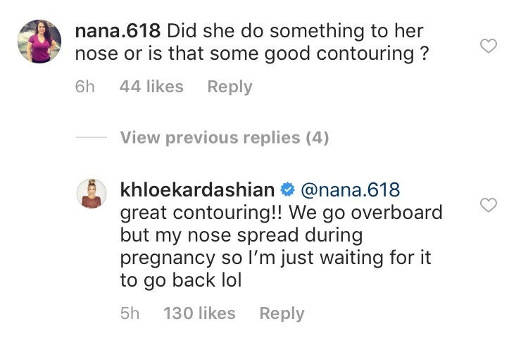 Khloe Kardashian Nose Job Comment