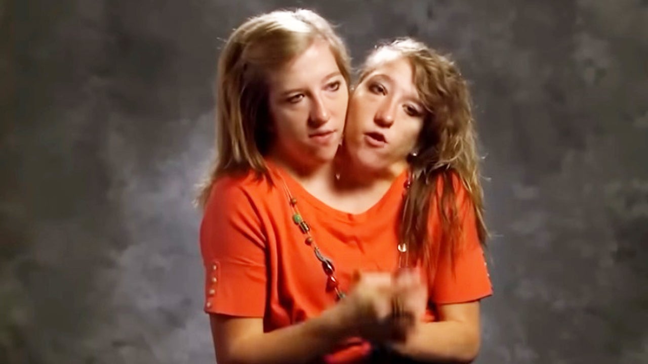 Conjoined Twin Abby Hensel of TLC's 'Abby & Brittany' Is Married