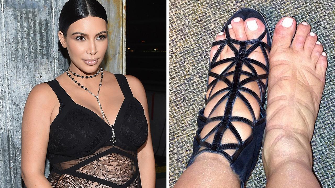 Kim Kardashian Deals With Swollen Feet During Pregnancy -- See the Pics! 
